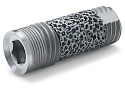 Trabecular Dental Implant in the UK