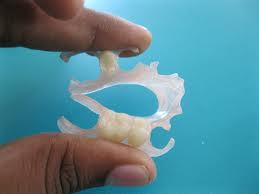 felxible-dentures