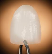 lumineer
