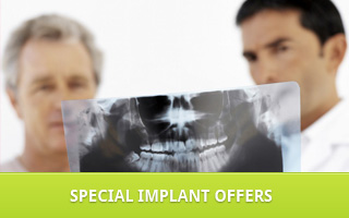 special_implant_offer.jpg