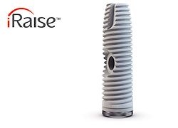 Sinus Lift Dental Implant with Crown Sinus Lift Dental Implant with Crown