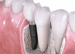 Aesthetic Dentistry Remedies
