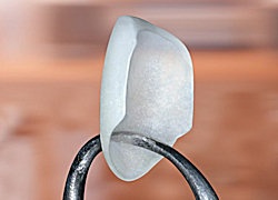 Dental Veneers