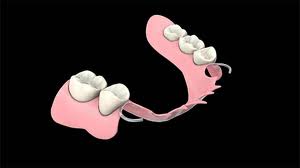 partial-dentures